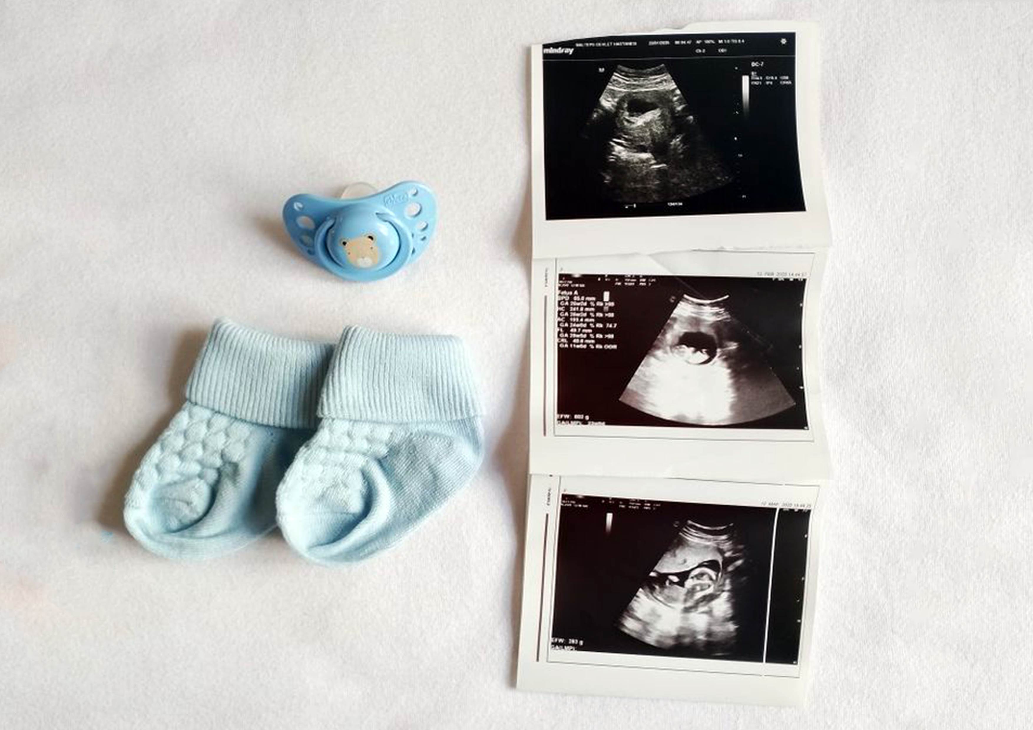 شبهات فرزند آوری (کلی و تربیتی و پزشکی)